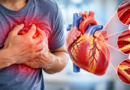 Understanding Coronary Artery Disease and Its Treatment – India Times Group