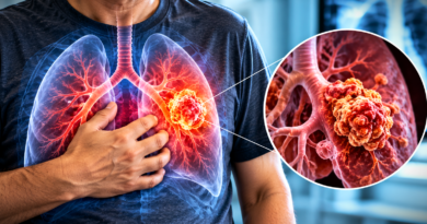 Lung Cancer: Risk Factors, Diagnostic Tests, and Treatment – India Times Group